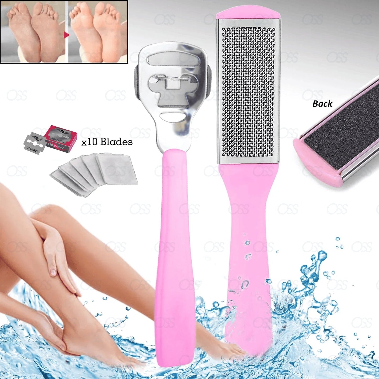 Foot Rasp File Scrubber Hard Dead-Rough Skin Callus Remover Dual Sided Pedicure