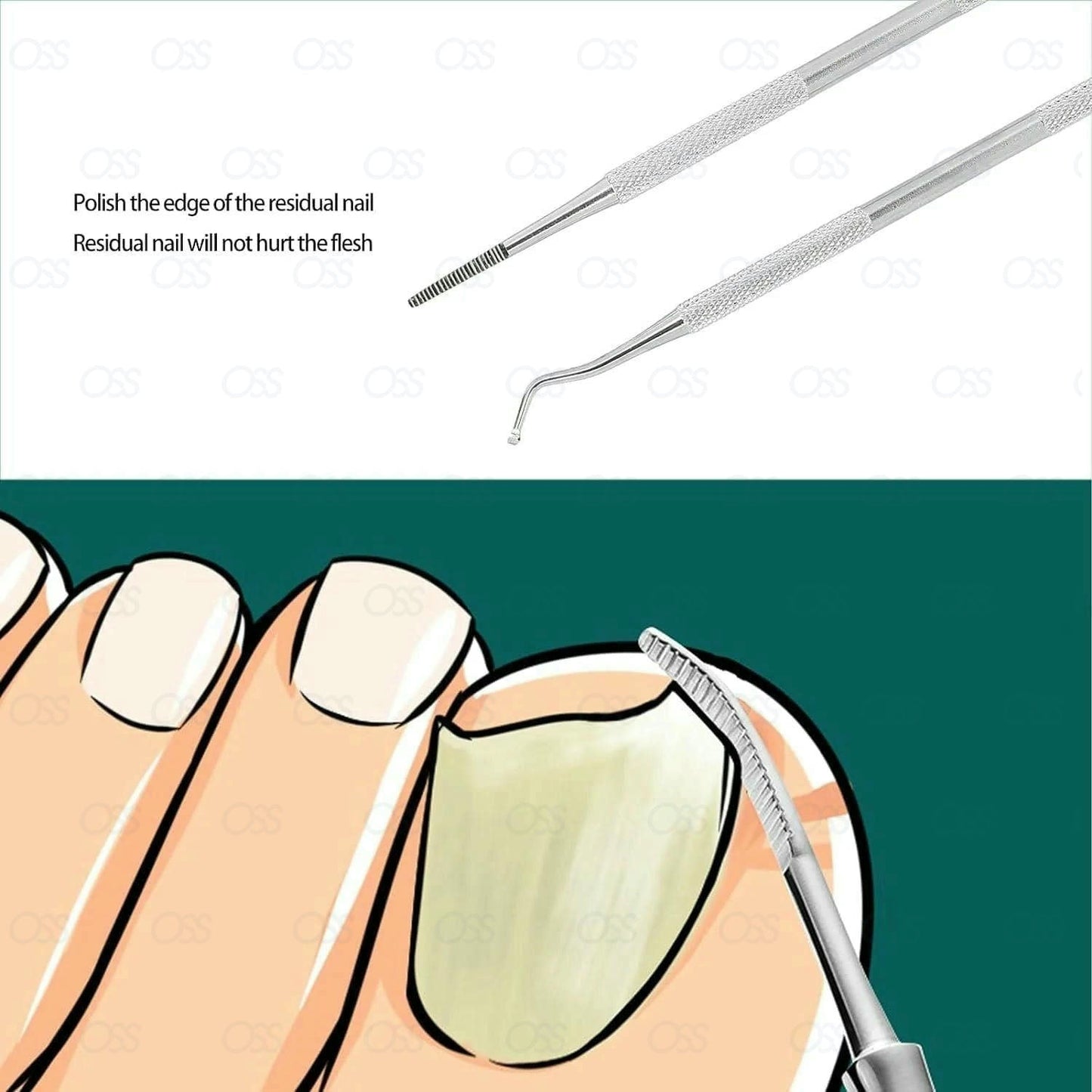 2pcs Toenail Cleaner Tools, Ingrown Toenail Tools, Stainless Steel Nail Picker Dual Ends Nail File, Toenail Cleaner Tools, Professional Safe Nail Treatment Pedicure Tool Kit