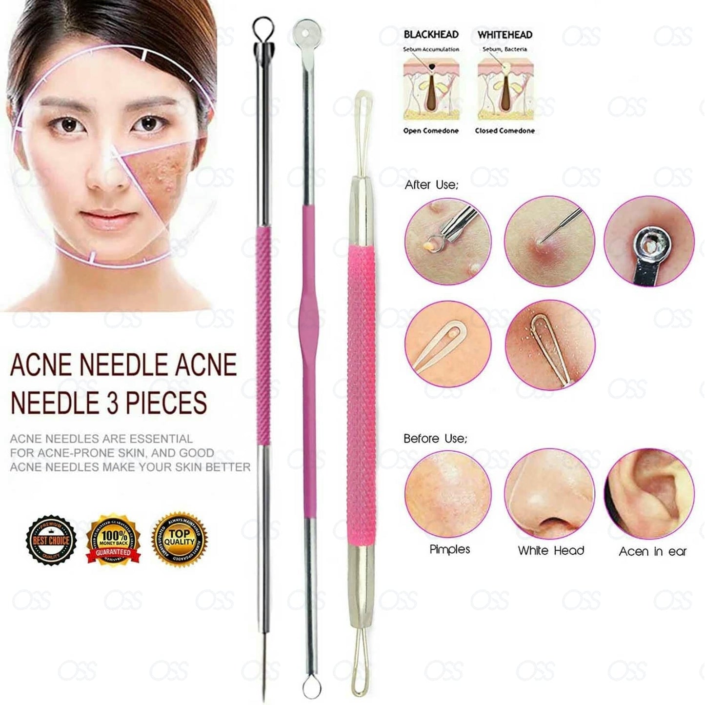 Blackhead Remover Tool - 3 Pcs Set