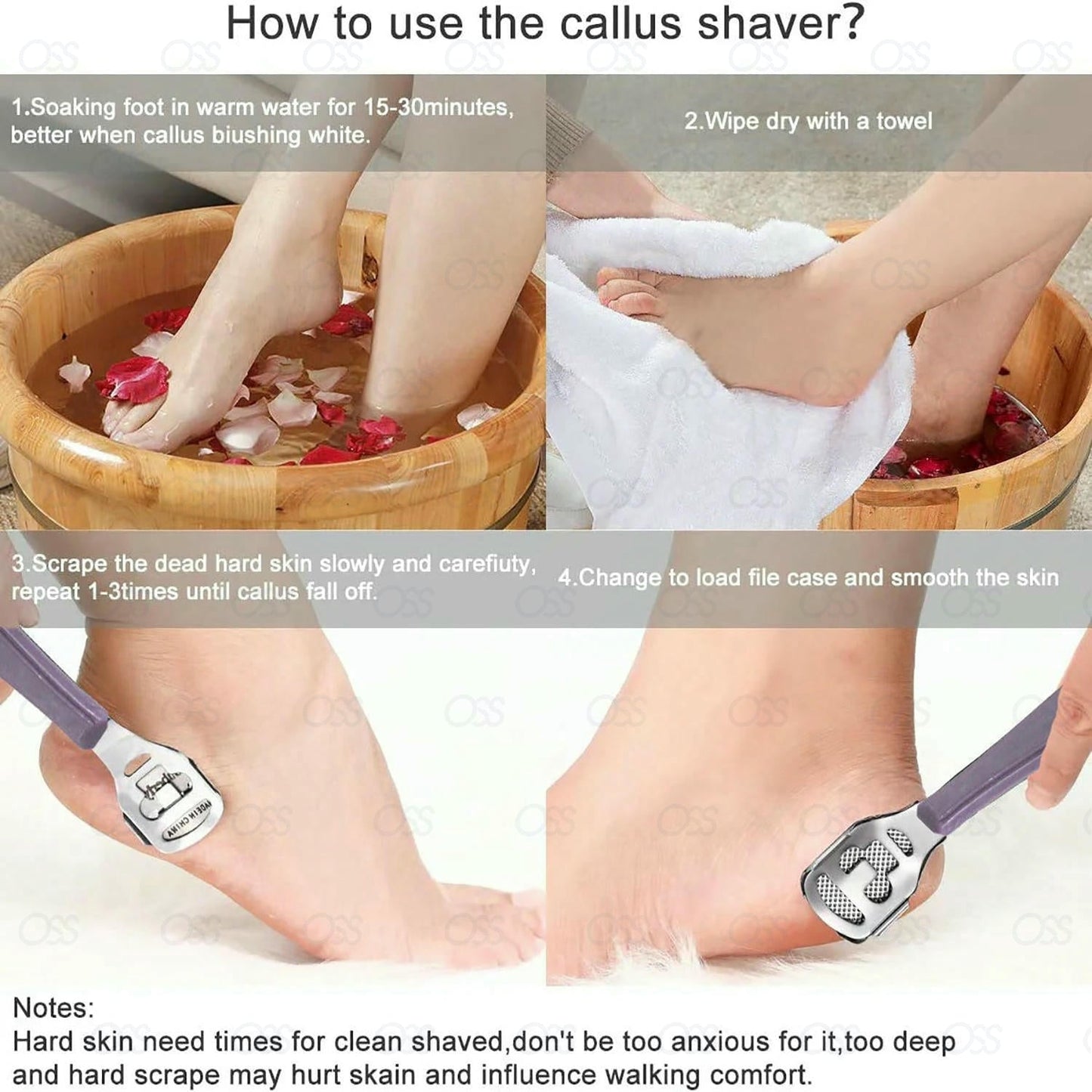 Callus remover Callus Corn Hard Skin Remover Shaver Foot Scraper Pedicure Kit